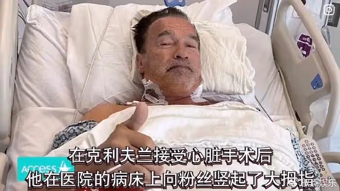 76歲施瓦辛格真變終結者了！裝心臟起搏器，之前做過3次心臟手術