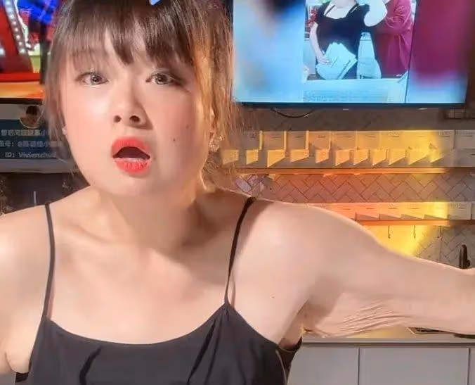 港星陳嘉佳減肥後遺症曝光！聳肩、脫髮、站不穩，連累賈玲遭質疑