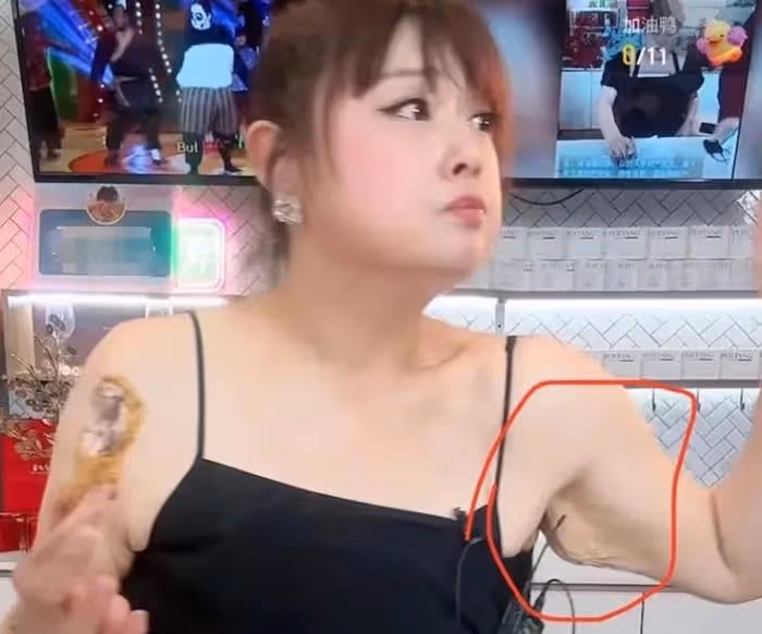 港星陳嘉佳減肥後遺症曝光！聳肩、脫髮、站不穩，連累賈玲遭質疑