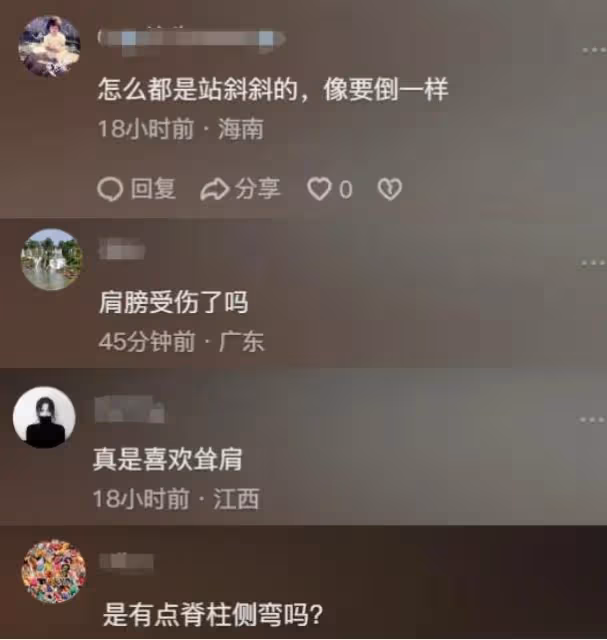 港星陳嘉佳減肥後遺症曝光！聳肩、脫髮、站不穩，連累賈玲遭質疑