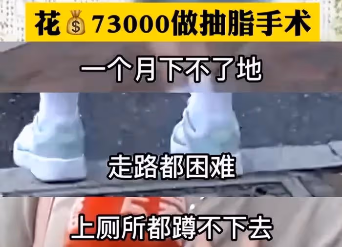 港星陳嘉佳減肥後遺症曝光！聳肩、脫髮、站不穩，連累賈玲遭質疑