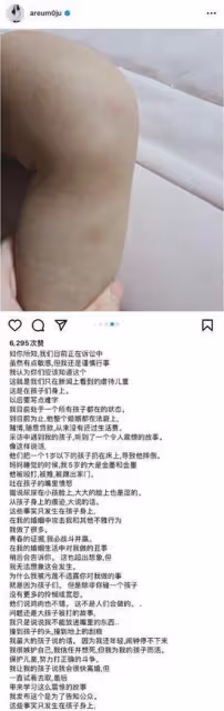 天啊！t-ara女團成員李雅凜自殺未遂，丈夫被曝對大兒子小便事件