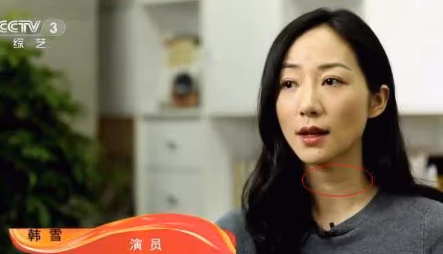 韓雪錄節目沒開濾鏡,脖子上「褶子」直接暴露年齡,男粉絲懵了