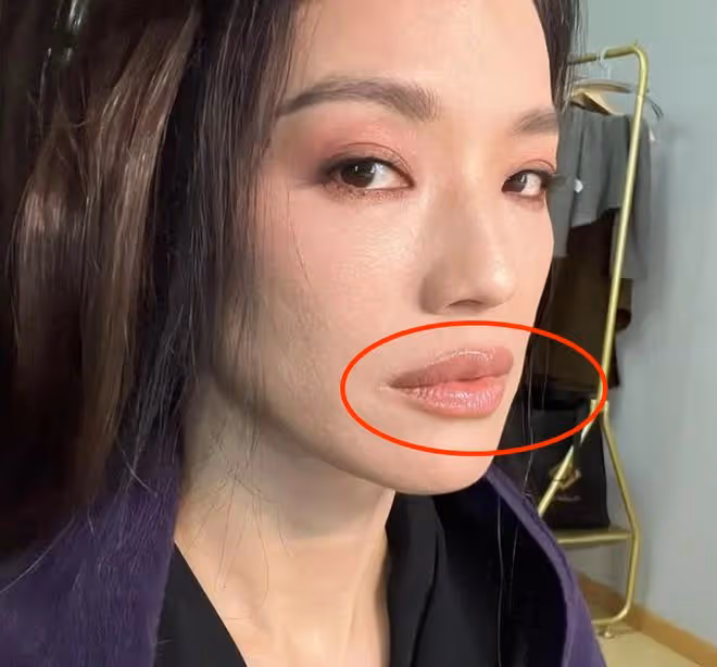 年紀越大嘴越小，難怪網友懷疑姚晨、劉亦菲做了縮唇手術！