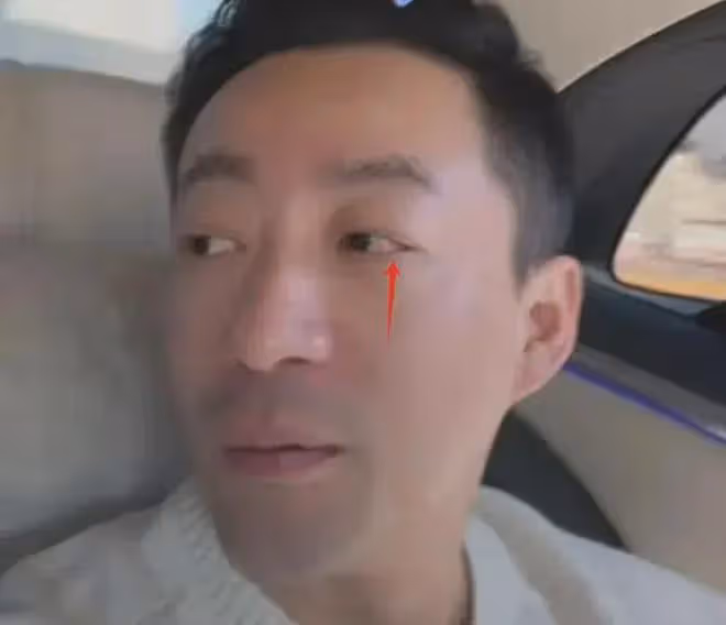 汪小菲求婚成功後首露面,帶未婚妻出門溜達,面容憔悴滿眼發紅