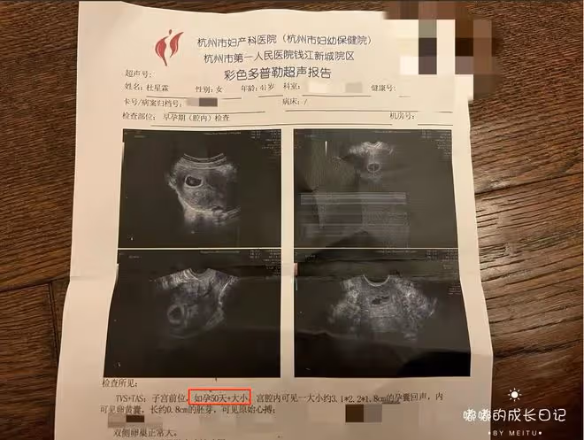 張紀中嬌妻回應懷四胎，72歲張導化身奶爸，拍胸脯保證會親自帶娃