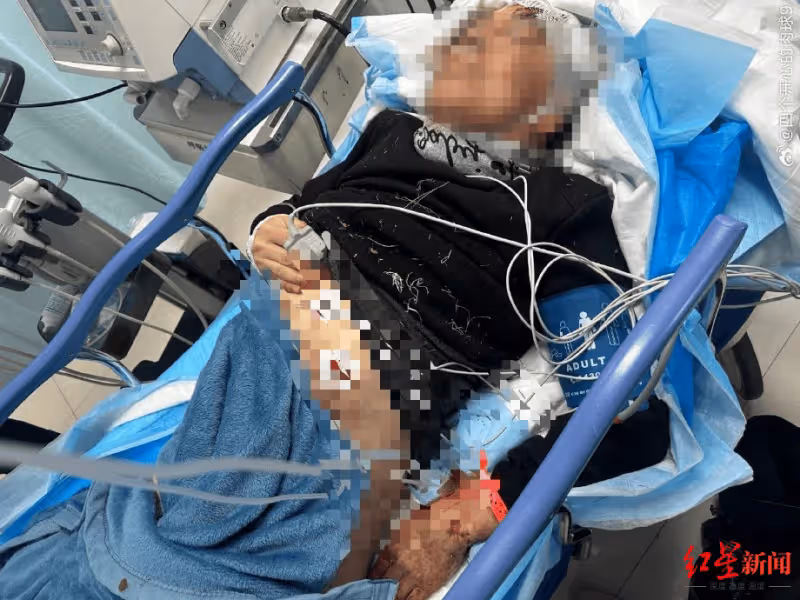 62歲男子徒步被多條大狗追咬，全身縫300多針！