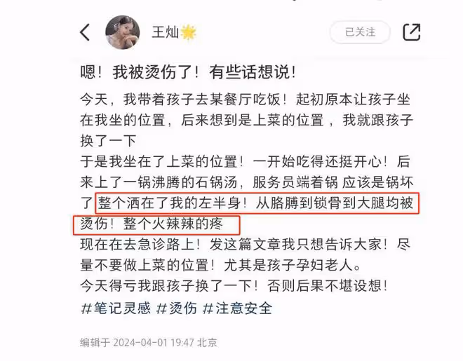 杜淳老婆帶女兒吃飯,左半身被沸湯燙傷,幸運及時跟孩子換了位置