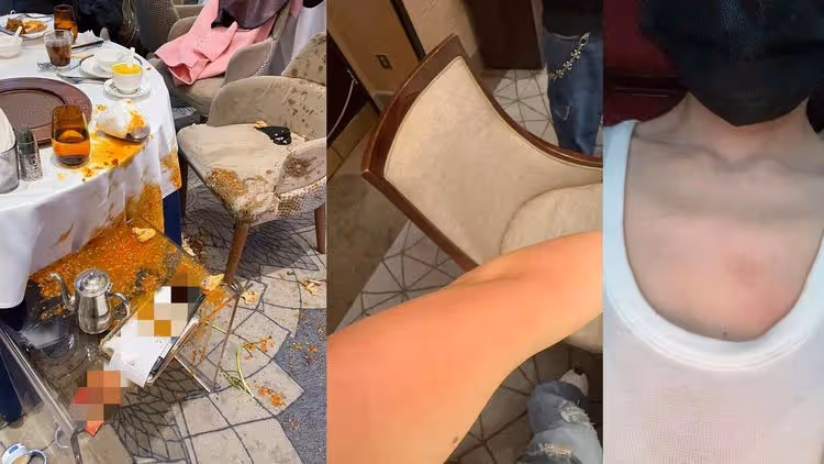 服務生端湯「鍋子壞了」　男星老婆慘遭熱湯潑身：還好先跟小孩換座位