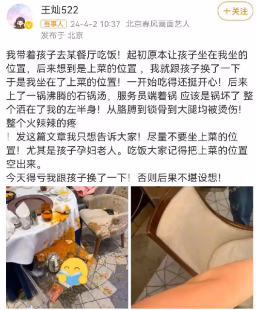 杜淳嬌妻王燦遭燙傷，驚險瞬間曝光引熱議