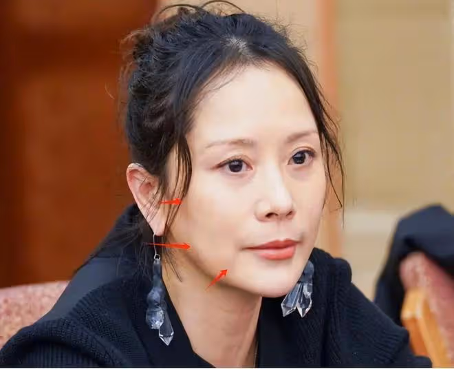 47歲海清生圖蒼老認不出，髮際線高幹癟鬆弛，自然衰老卻被誇