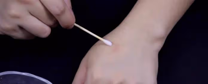 滅蚊別再用蚊香了！　教你一個「鄉下老方法」簡單又有效：蚊子再也不敢進家門