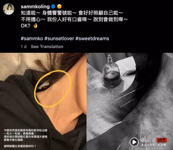 高密度行程導致！高海寧健康亮紅燈 頸部出現兩大硬塊！