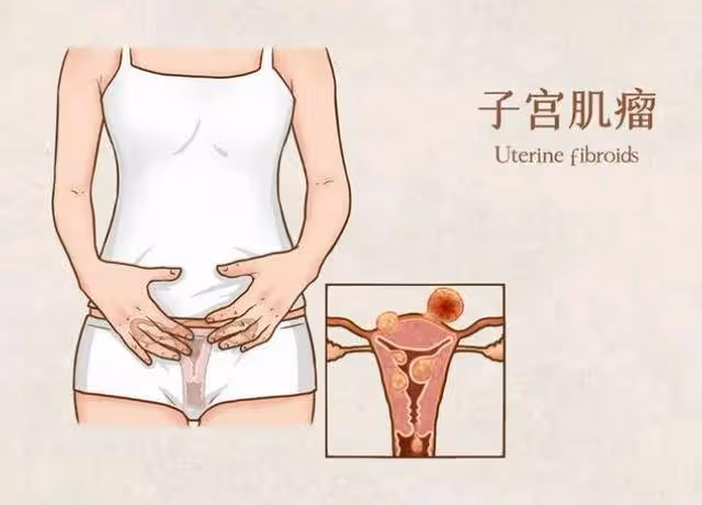 ​女人摘掉子宮後！和正常的女性有何不同　醫生說實話「有3個大變化」要提前護好健康