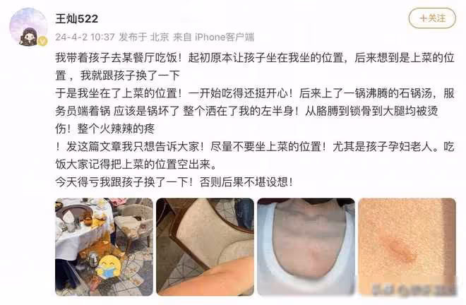 杜淳老婆燙傷事件：一張照片引發的安全提醒
