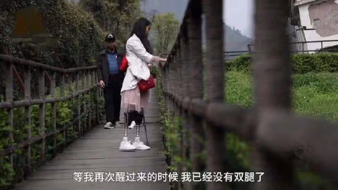 意外失去雙腿,又被丈夫拋棄,她卻笑對人生,活出別樣的精彩