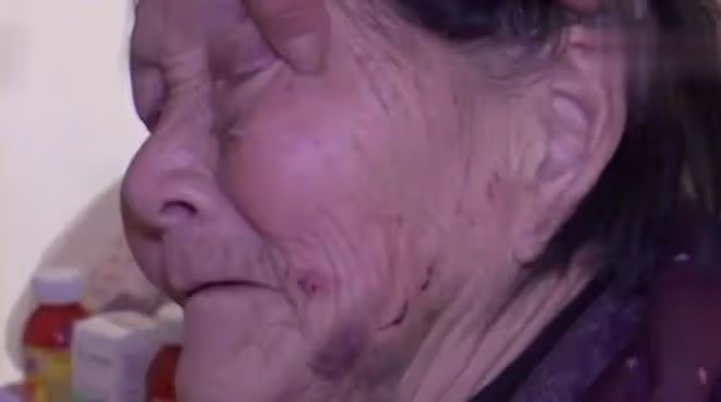 只因一口麥片，84歲老太遭到90歲丈夫毒打，滿臉都是傷口讓人心痛