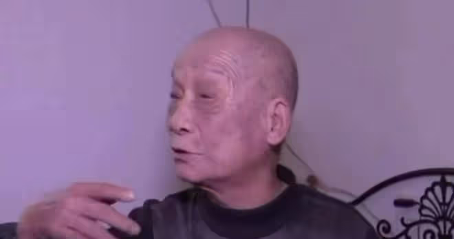 只因一口麥片，84歲老太遭到90歲丈夫毒打，滿臉都是傷口讓人心痛