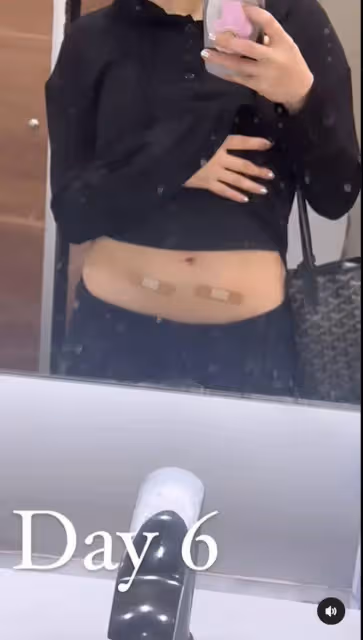 33歲TVB女星男友破產後凍卵！否認買房為結婚：給我自己