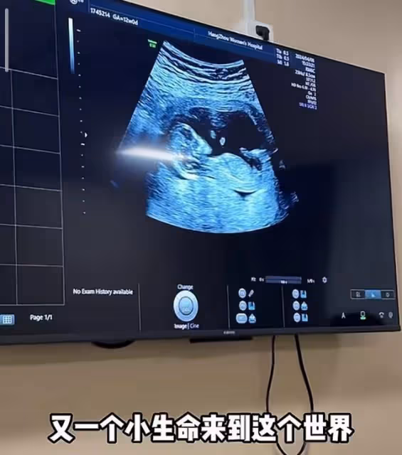 72張紀中陪孕妻產檢，四胎寶寶非常健康，老父親聽到胎心感動落淚