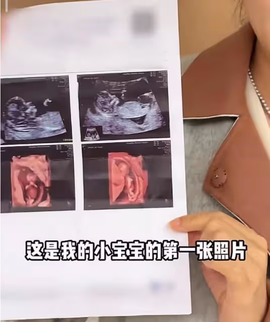 72張紀中陪孕妻產檢，四胎寶寶非常健康，老父親聽到胎心感動落淚