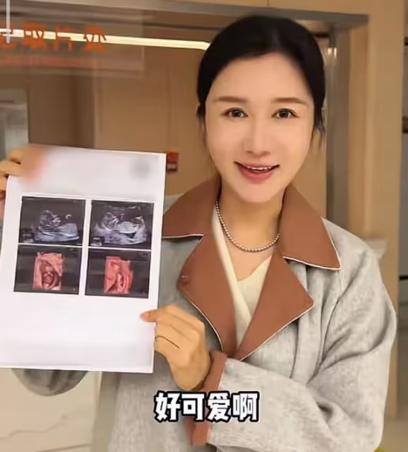 72張紀中陪孕妻產檢，四胎寶寶非常健康，老父親聽到胎心感動落淚