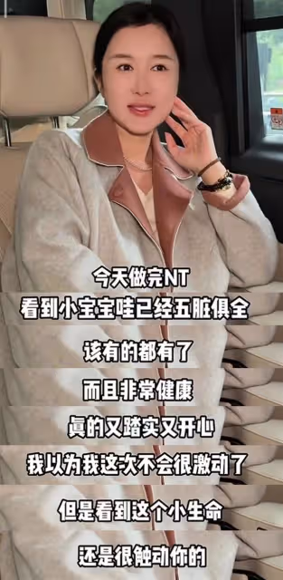 72張紀中陪孕妻產檢,四胎寶寶非常健康,老父親聽到胎心感動落淚
