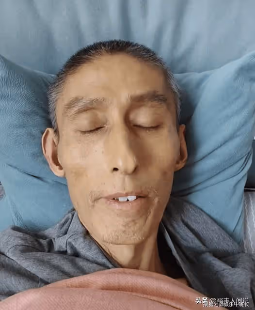 47歲網紅「毛毛」去世!三年化療瘦到脫相,模樣似80歲惹人感慨