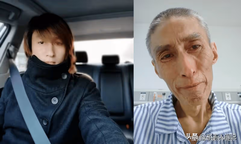 47歲網紅「毛毛」去世!三年化療瘦到脫相,模樣似80歲惹人感慨