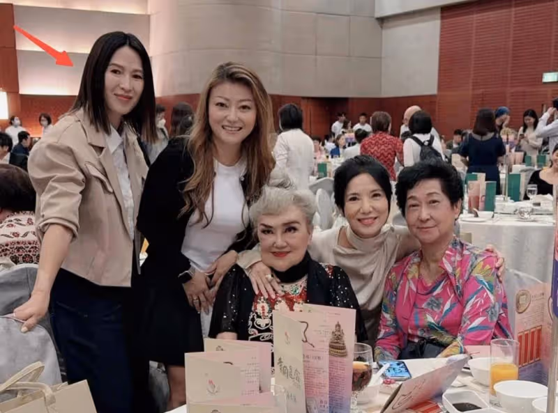 TVB前知名女星罕見亮相！大小眼情況嚴重，曾拍攝燒傷要植皮