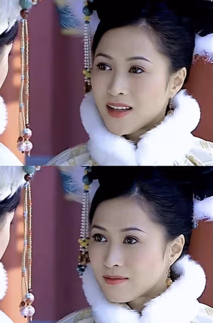TVB前知名女星罕見亮相！大小眼情況嚴重，曾拍攝燒傷要植皮