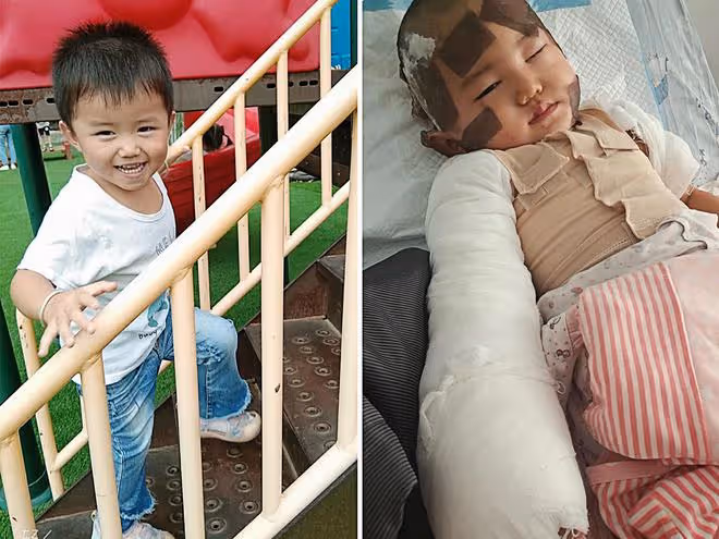 中秋團圓一家人忙碌時，廚房傳出一聲慘叫，3歲幼童出大事了