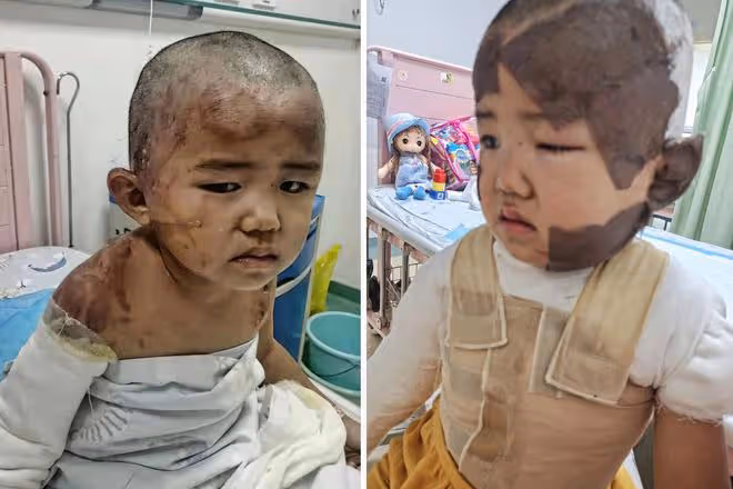 中秋團圓一家人忙碌時，廚房傳出一聲慘叫，3歲幼童出大事了