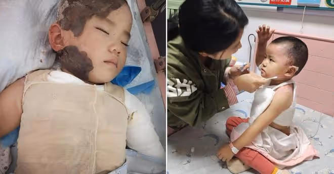 中秋團圓一家人忙碌時，廚房傳出一聲慘叫，3歲幼童出大事了