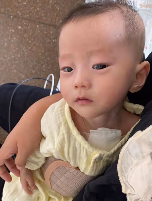 5個月產檢發現問題,夫妻不忍放棄,雙胞胎姐妹出生結果喜憂參半