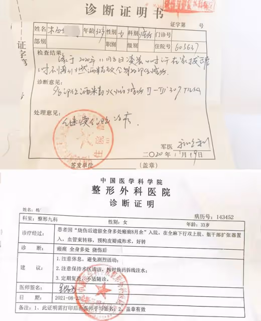 美媽凌晨拔火罐欲解酸痛,不料發生悲劇,從此全身戴上「緊箍咒」