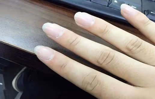 吸菸者，若身體此處出現「凸起」時，或是肺在求你戒菸，別再抽了