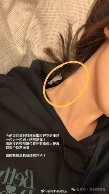 TVB當紅畫到哪突發入院!月初頸部有硬塊求救 直認身體響警號
