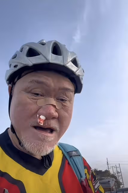 69歲TVB御用惡霸山地騎行出意外！傷及鼻樑鼻血直流，直認要服老