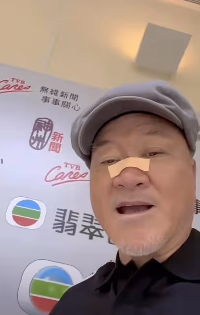 69歲TVB御用惡霸山地騎行出意外！傷及鼻樑鼻血直流，直認要服老