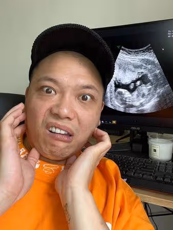 快訊／《瘋神無雙》阿虎驚喜宣布當爸！　超音波前又驚又喜：你選了我