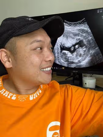 快訊／《瘋神無雙》阿虎驚喜宣布當爸！　超音波前又驚又喜：你選了我