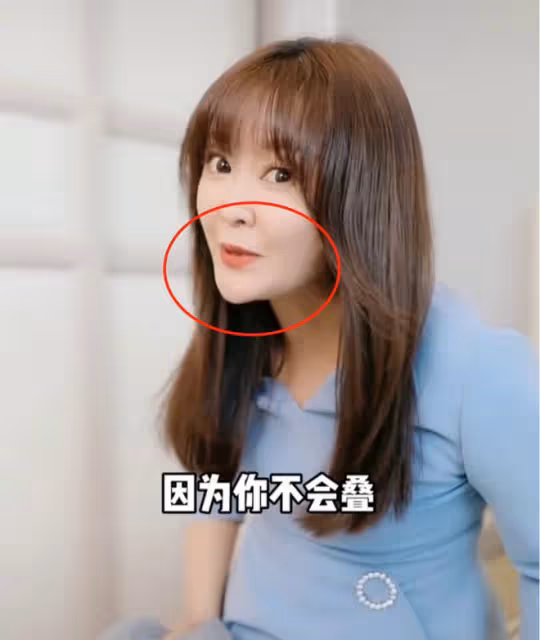 50歲王小騫變身「蛇精臉」！法令紋顯著下巴突出，到底怎麼了？