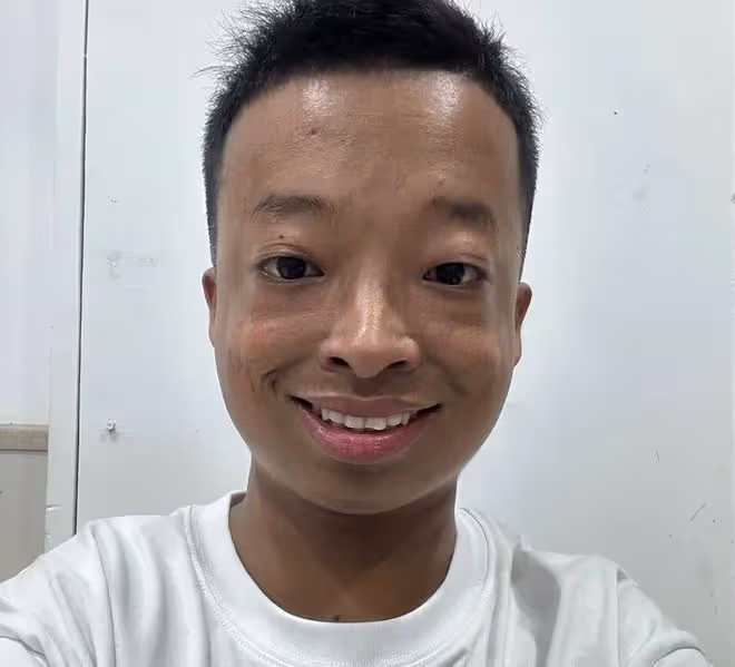 太心酸！網紅"咖啡豆"自曝近況，穿病號服已截肢，尊稱先生引熱議