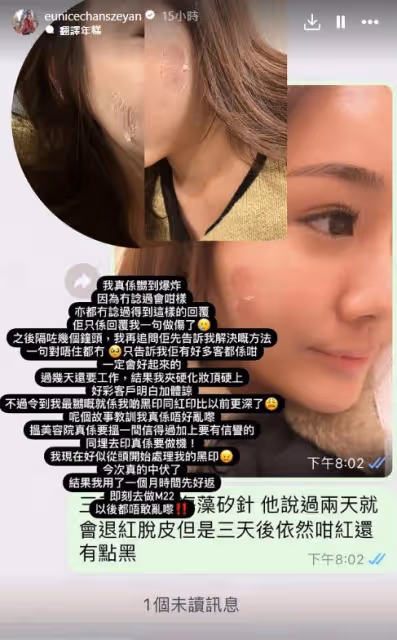 TVB離巢小花慘遭毀容，美容院護膚反變爛臉，發現時叫停已太遲