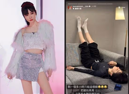 謝金燕拍陸綜「雙腿受傷嚴重變形」大哭！大片瘀青疑血栓　半夜急送醫