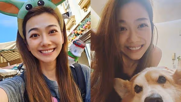 邵庭「眼角爆血管」!不明瘀青照曝光 老公掛保證:沒趁睡覺動手