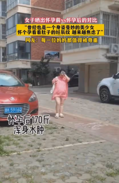 女子曬出懷前和孕後對比,反差讓她焦慮,網友:媽媽都值得被尊重