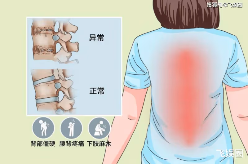李宇春患不死癌症流淚稱：我的財富除了交治療費已別無他用。