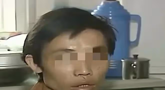 變態男子懷疑妻子出軌,用蠟燭折磨妻子,丈母娘 畜生不如